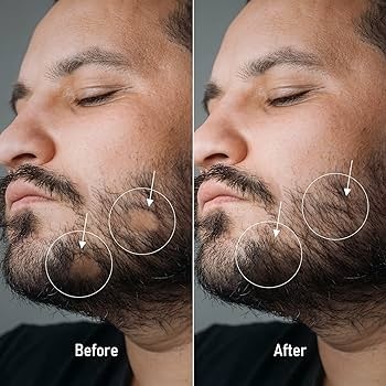 Лосьйон для зростання бороди Minox 7% (200мл, вистачає на 4 місяці) 20 фото