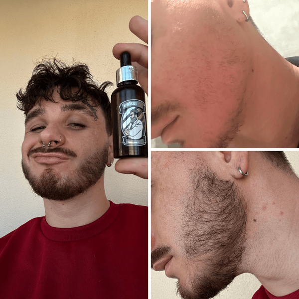 MinoX 15 - Лосьон для роста волос и бороды (50 мл) 17 фото