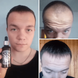 MinoX 15 - Лосьон для роста волос и бороды (50 мл) 17 фото 3