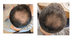 Набір для росту волосся та бороди Turbo Max 54332 фото 2