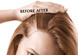 Комплекс для росту та відновлення волосся для жінок  78008 фото 2