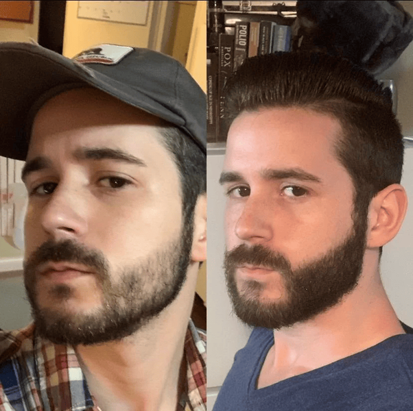 Комплекс для росту бороди посилений  5454545 фото