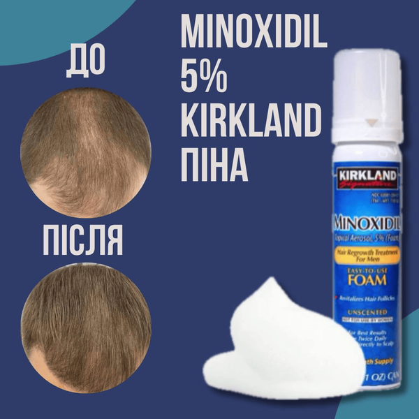 Піна minoxidil 5% KIRKLAND (1 флакон) 4 фото