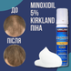 Пена minoxidil 5% KIRKLAND (1 флакон) 4 фото 7